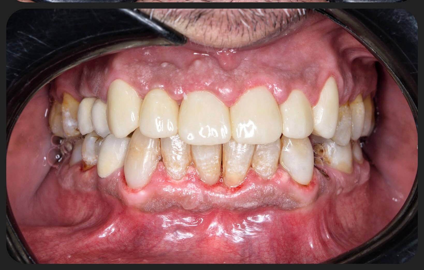 After — Smile makeover